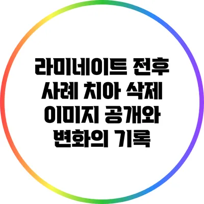 라미네이트 전후 사례: 치아 삭제 이미지 공개와 변화의 기록